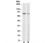 Western blot testing of human A431 [A] and mouse NIH3T3 [B] cell lysates with Gamma Catenin antibody at 0.3ug/ml. Predicted molecular weight ~82 kDa.