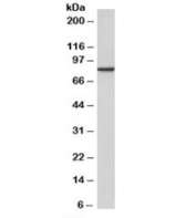 Western blot testing of A431 cell lysate with Gamma Catenin antibody at 2ug/ml. Predicted molecular weight ~82kDa. An NAP blocker was used in place of non-fat milk as blocking solution and diluent. (1)