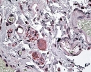 IHC staining of FFPE human intestine with NPY5R antibody at 4ug/ml. HIER: steamed with pH6 citrate buffer, AP-staining.