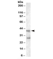 Western blot testing of Jurkat lysate with SCAP2 antibody at 0.5ug/ml. Both the expected 40kDa and additional 28kDa band block with the addition of immunizing peptide.~