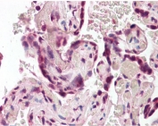 IHC testing of FFPE human placenta tissue with SODD antibody at 3.75ug/ml. Required HIER: steamed antigen retrieval with pH6 citrate buffer; AP-staining.