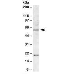 Western blot testing of HEK293 lysate with SODD antibody at 1ug/ml. Predicted molecular weight: ~50kDa, observed here at ~60kDa. Both observed bands block with the addition of immunizing peptide. ~