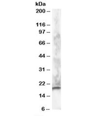 Western blot testing of human brain lysate with CABP1 antibody at 1ug/ml. Predicted molecular weight: ~26/19kDa (L/S isoforms), observed here at ~19kDa.