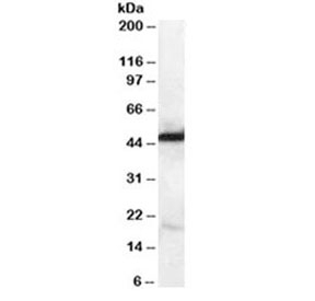 Western blot testing of human kidney lysate with NDRG1 antibody at 0.1ug/ml. Predicted molecular weight ~43kDa.