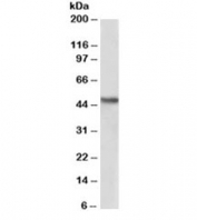Western blot testing of human kidney lysate with NDRG1 antibody at 2ug/ml. Predicted molecular weight ~43kDa. An NAP blocker was used in place of non-fat milk as blocking solution and diluent. (1)