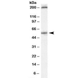 Western blot testing of human colon lysate with Serotonin receptor 3A antibody at 0.3ug/ml. Both the expected 55kDa band and the additional ~200kDa band block with the addition of immunzing peptide.~