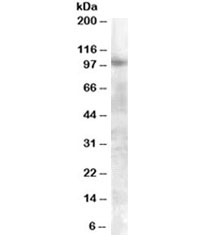 Western blot testing of A549 lysate with FGFR2 antibody at 0.3ug/ml. Predicted molecular weight of multiple isoforms: 80-120 kDa.