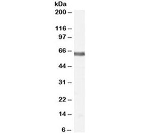 Western blot testing of human thyroid lysate with NUR77 antibody at 2ug/ml. Predicted molecular weight ~64kDa (isoform 1).~