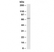 Western blot testing of human Jurkat lysate with RACGAP1 antibody at 1ug/ml. Predicted molecular weight: ~71 kDa.