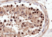 IHC staining of FFPE human testis with RACGAP1 antibody at 4ug/ml. HIER: microwaved with pH9 Tris/EDTA buffer, HRP-staining.