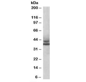 Western blot testing of human muscle lysate with MURF3 antibody at 1ug/ml. Predicted molecular weight: ~43/38kDa (isoforms 1/2).~