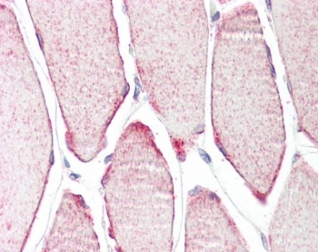 IHC testing of FFPE human skeletal muscle tissue with MURF3 antibody at 3.75ug/ml. Required HIER: steamed