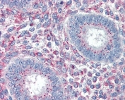 IHC testing of FFPE human uterus tissue with PRRX1 antibody at 5ug/ml. Required HIER: steamed antigen retrieval with pH6 citrate buffer; AP-staining.