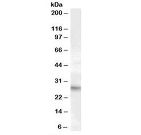 Western blot testing of human heart lysate with PRRX1 antibody at 1ug/ml. Predicted/observed molecular weight: ~27kDa.~