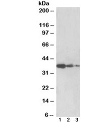 Western blot testing of human liver lysate [lane 1], mouse liver [lane 2] and rat liver [lane 3] with PP2A antibody at 0.5ug/ml. Predicted molecular weight ~36kDa.
