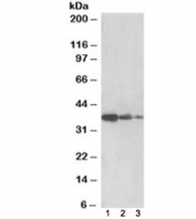 Western blot testing of human liver lysate [lane 1], mouse liver [lane 2] and rat liver [lane 3] with PP2A antibody at 0.5ug/ml. Expected molecular weight: 37/41/33/32 kDa (alpha/beta/delta/epsilon isoforms).