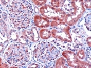 IHC staining of FFPE human kidney with DCXR antibody at 1ug/ml. HIER: microwaved with pH6 citrate buffer, HRP-staining.