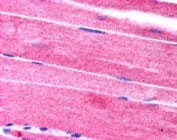 IHC testing of FFPE human skeletal muscle with SORBS1 antibody at 2.5ug/ml. HIER: steamed with pH6 citrate buffer, AP-staining.