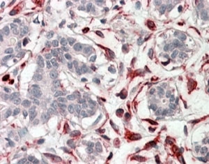 IHC testing of FFPE human breast with CXXC4 antibody at 4ug/ml. HIER: steamed with pH6 citrate buffer, AP-staining.