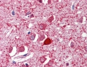 IHC testing of FFPE human brain cortex with Parvalbumin antibody at 2.5ug/ml. Required HIER: steamed antigen retrieval with pH6 citrate buffer; AP-staining.