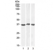 Western blot testing of human 1) liver, 2) testis and 3) tonsil lysate with GAPDH antibody at 0.1/0.03/0.03 ug/ml, respectively. Predicted molecular weight ~36 kDa.
