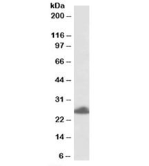 Western blot testing of human placenta lysate with TRIM40 antibody at 0.5ug/ml. Predicted molecular weight: ~29/26kDa (isoforms 1/2), observed here at ~26kDa.