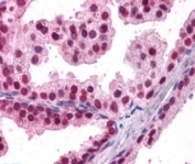 IHC staining of FFPE human prostate with FOXA2 antibody at 4ug/ml. HIER: steamed with pH6 citrate buffer, AP-staining.