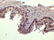 IHC staining of FFPE human prostate tissue with FOXA1 antibody at 2ug/ml. HIER: steamed with pH6 citrate buffer, HRP-staining.