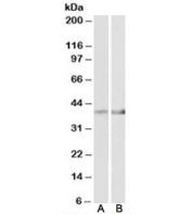 Western blot of mouse heart (A) and mouse muscle (B) lysate with IDH3B antibody at 2ug/ml. Predicted molecular weight: ~42kDa.