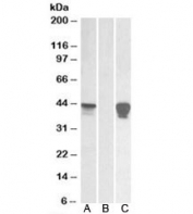 Western blot of HEK293 lysate overexpressing human SLAMF8-MYC probed with SLAMF8 antibody [0.01ug/ml] in (A) and anti-MYC [1/1000] in (C). Mock-transfected HEK293 probed with SLAMF8 antibody [0.01ug/ml] in (B). Predicted molecular weight: ~32/45kDa (unmodified/glycosylated).