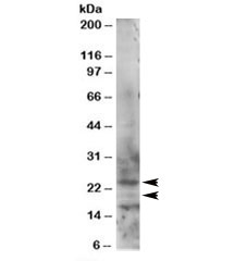 Western blot testing of HeLa lysate with RAB2 antibody at 1ug/ml. Isoforms of 24kDa and 21kDa can be detectd.
