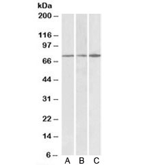 Western blot testing of human cerebral cortex [A], human frontal cortex [B] and mouse brain [C] lysates with PAPD5 antibody at 0.3ug/ml. Predicted/observed molecular weight: ~76/74kDa (human/mouse, isoform a).