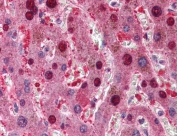 IHC testing of FFPE human liver tissue with p16 antibody at 5ug/ml. Required HIER: steamed antigen retrieval with pH6 citrate buffer; AP-staining.