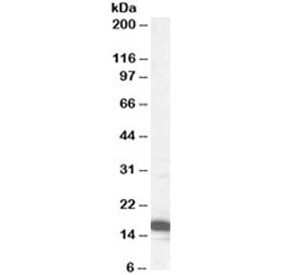 Western blot testing of HeLa lysate with p16 antibody at 1ug/ml. Predicted molecular weight ~16kDa.~