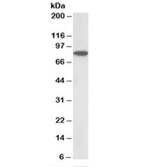 Western blot of rat skeletal muscle lysate with BBS7 antibody at 0.5ug/ml. Predicted molecular weight: ~80kDa.