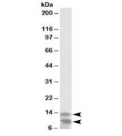 Western blot testing of K562 lysate with DPM3 antibody at 2ug/ml. Predicted molecular weight: ~10/13kDa (short/long isoform).