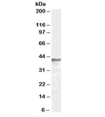 Western blot testing of human brain lysate with beta-Arrestin 2 antibody at 0.3ug/ml. Predicted molecular weight: 44~47kDa (isoforms 1-5).~