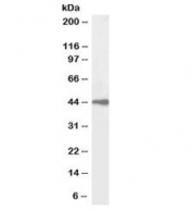 Western blot testing of human spleen lysate with biotinylated beta-Arrestin 2 antibody at 1ug/ml. Predicted molecular weight: 44~47kDa (isoforms 1-5).