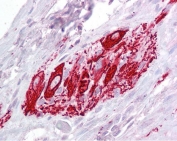 IHC testing of FFPE human small intestine tissue with ITM2B antibody at 2.5ug/ml. Required HIER: steamed antigen retrieval with pH6 citrate buffer; AP-staining.