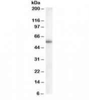 Western blot testing of human placenta lysate with Aromatase antibody at 0.1ug/ml. Predicted molecular weight ~58kDa.