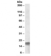 Western blot testing of human cerebellum lysate with SDHAF1 antibody at 0.3ug/ml. Predicted molecular weight: ~13kDa, observed here at ~19kDa.