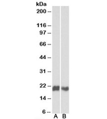 Western blot testing of Jurkat [A] and MOLT4 [B] lysates with CD3D antibody at 1ug/ml. Predicted molecular weight: ~19kDa.