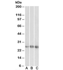Western blot testing of human heart [A], kidney [B] and lung [C] lysates with EGFL7 antibody at 1ug/ml. Predicted molecular weight: ~29/27kDa (pro/mature form).