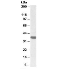 Western blot testing of human duodenum lysate with Calponin 3 antibody at 0.3ug/ml. Predicted molecular weight: ~36kDa.