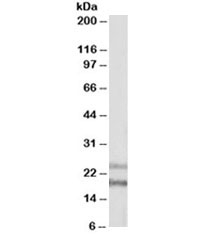 Western blot testing of human frontal cortex lysate with IL-22 antibody at 1ug/ml. Observed molecular weight: 19~25kDa depending on glycosylation level.