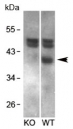 Western blot testing of mouse brain and  KO mouse brain lysates with RCAN1 antibody at 1ug/ml