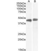 Western blot testing of A) human cerebellum and B) human hippocampus tissue lysates with TDP-43 antibody at 1ug/ml. Predicted molecular weight ~43 kDa.