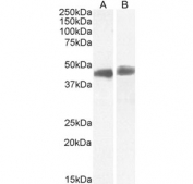 IHC staining of human prostate tissue with TDP-43 antibody. HIER: boil tissue sections in 10mM citrate buffer, pH 6, for 10-20 min followed by cooling at RT for 20 min.