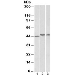 Western blot testing of human cerebellum (A), frontal cotex (B) and hippocampus (C) lysates with TDP-43 antibody at 1ug/ml. Pre