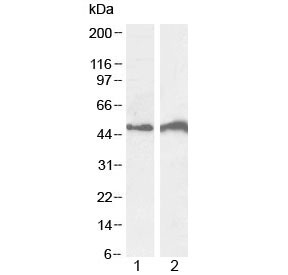 Western blot testing of human 1) Daudi and 2) Jurkat lysate with IRF4 antibody at 0.5ug/ml. Predicted molecular weight: 51 kDa.